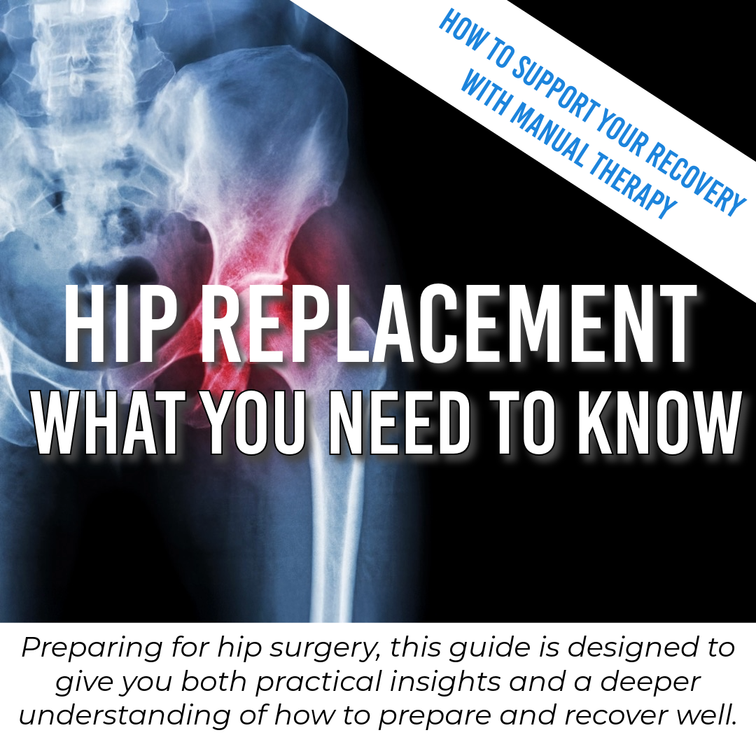 Hip Replacement: What You Need to Know